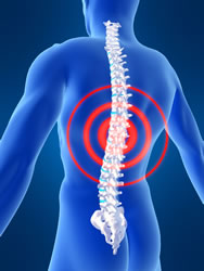 disc herniation nashville tn